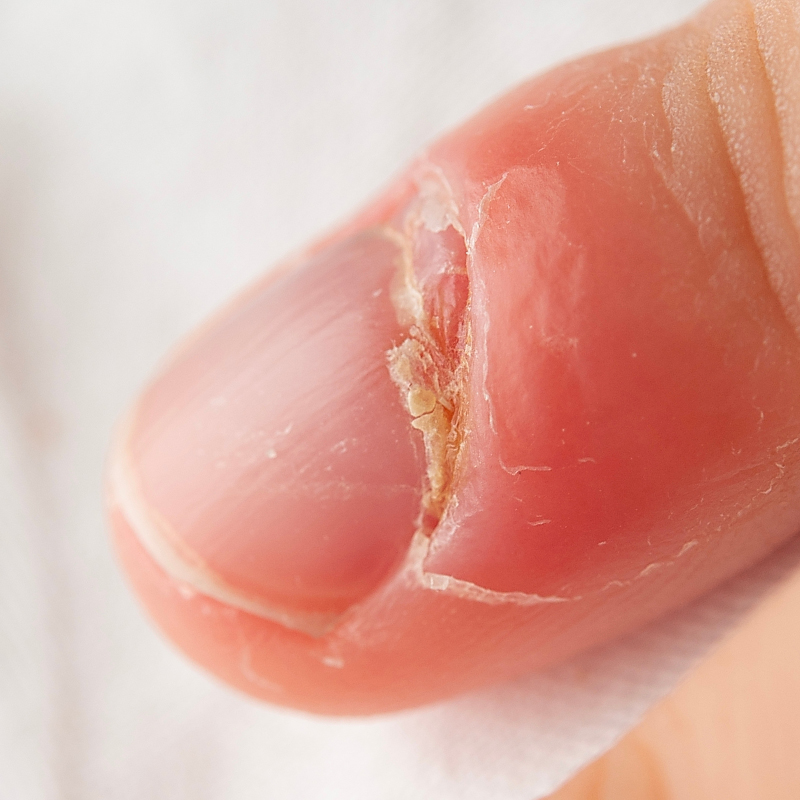 Com Unheiro (Paroníquia)