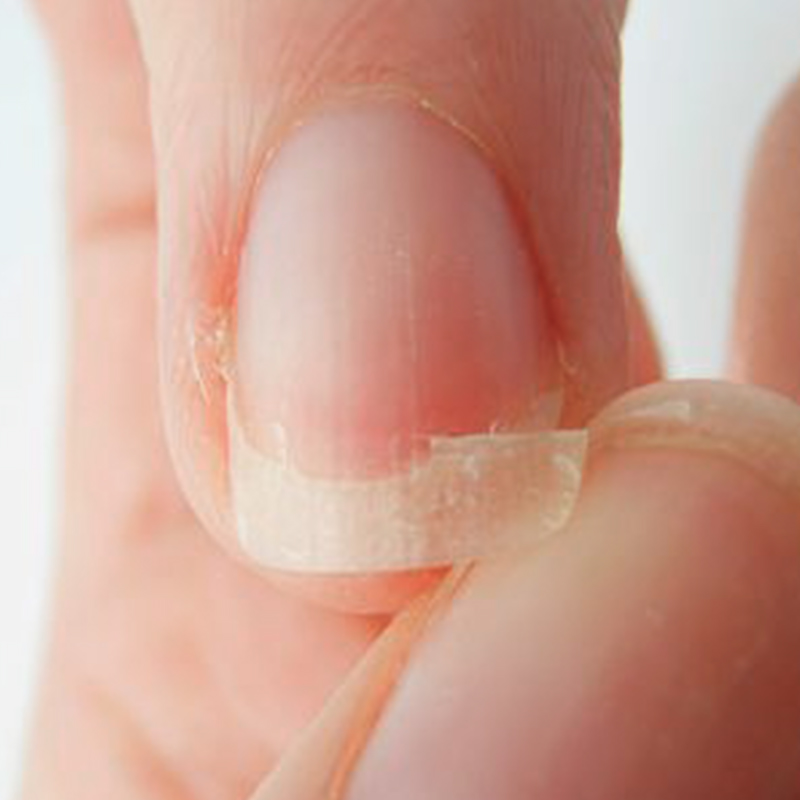 Unhas moles, quebradiça
