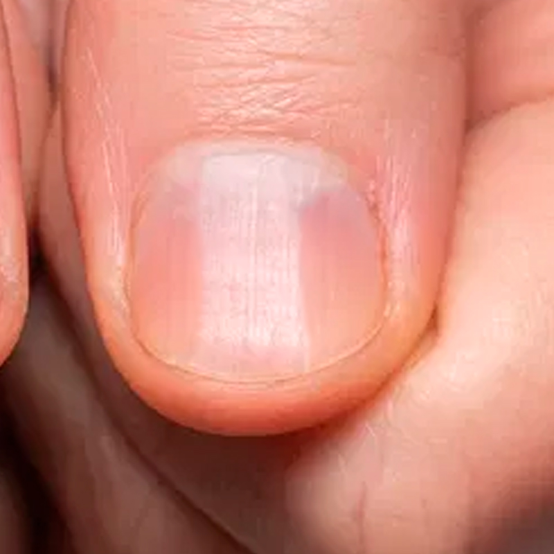 Com dificuldade de crescimento